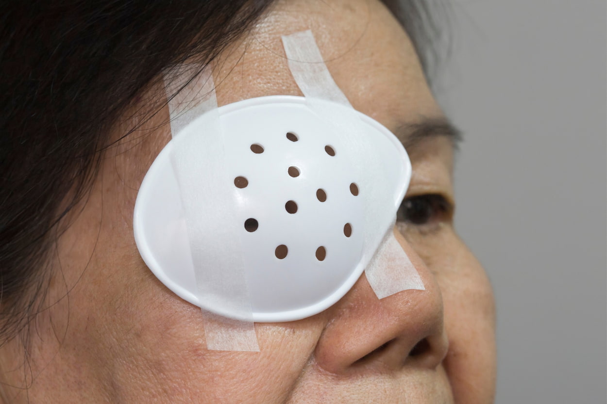 how long to wear eye shield at night after cataract surgery