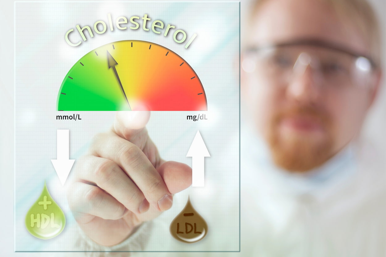 what is normal cholesterol level