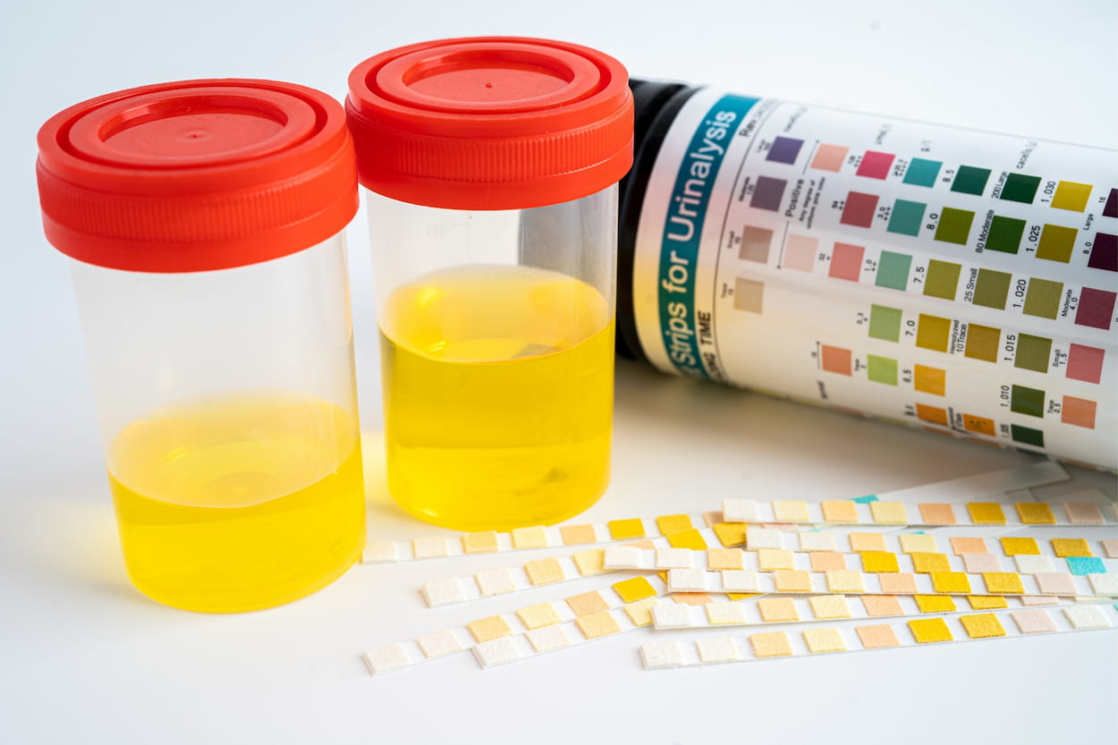 urine color chart what do different urine colors mean