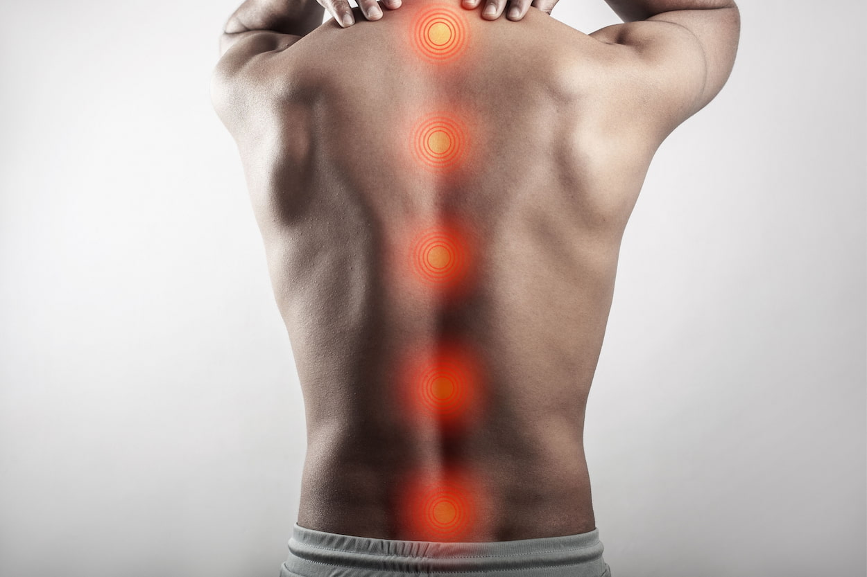 Spinal Fusion Surgery Cost in Turkey