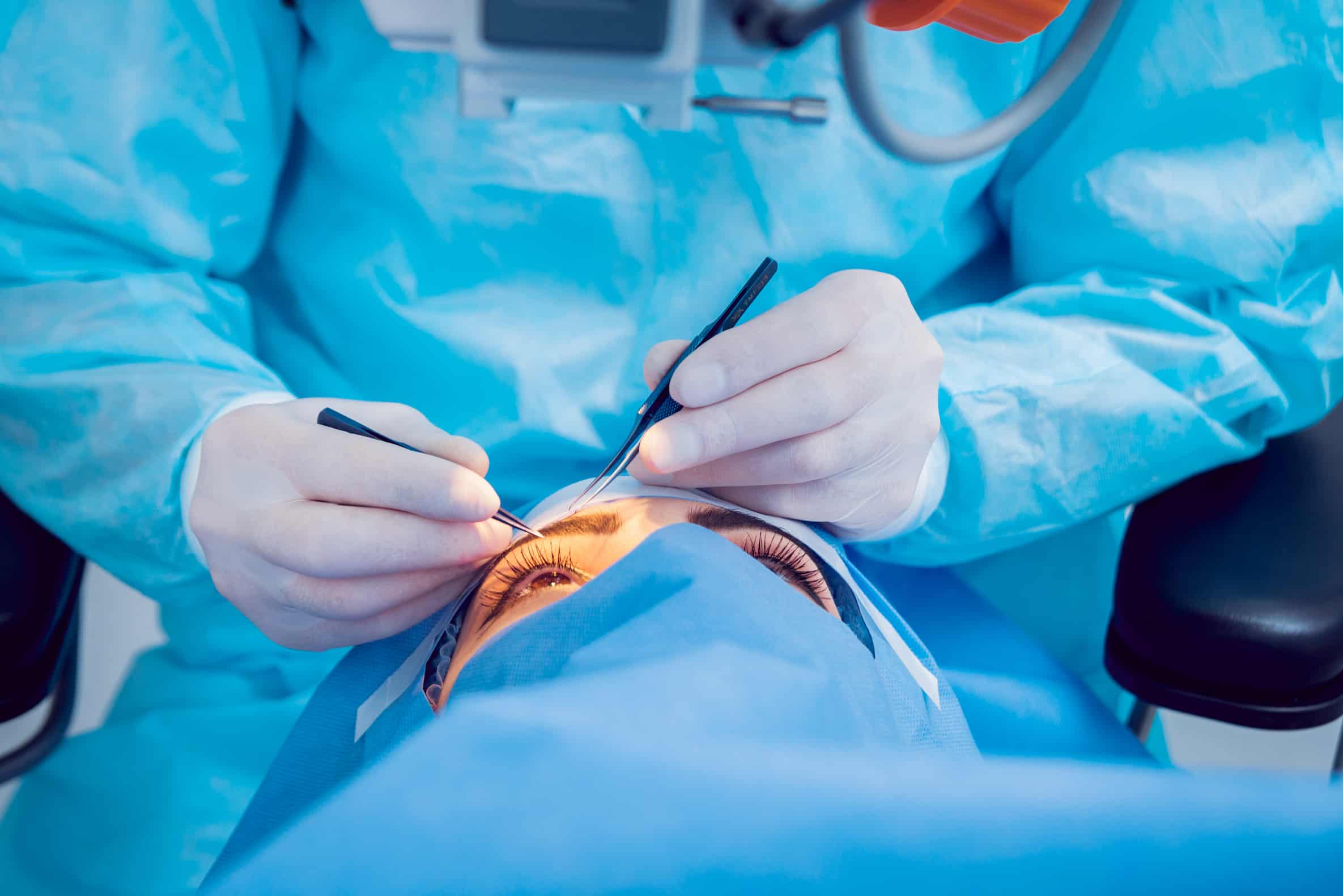 Chirurgie d'extraction extracapsulaire de la cataracte en turquie