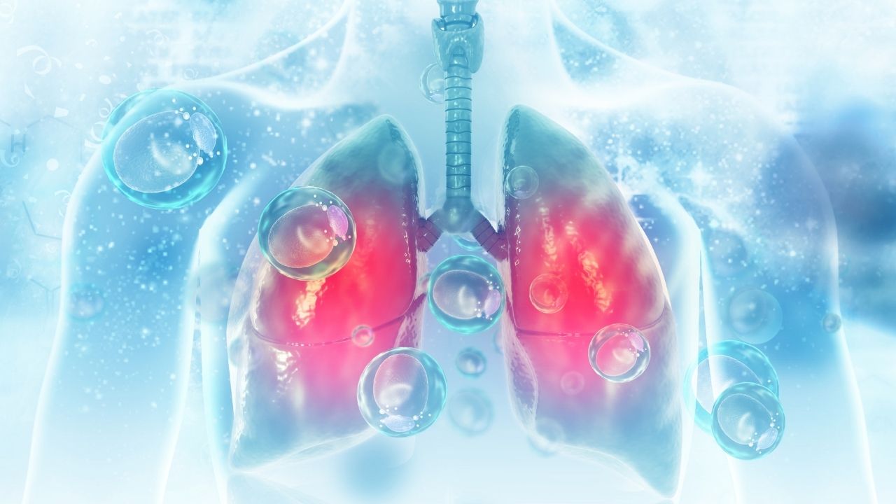 Lung transplantation trkiye