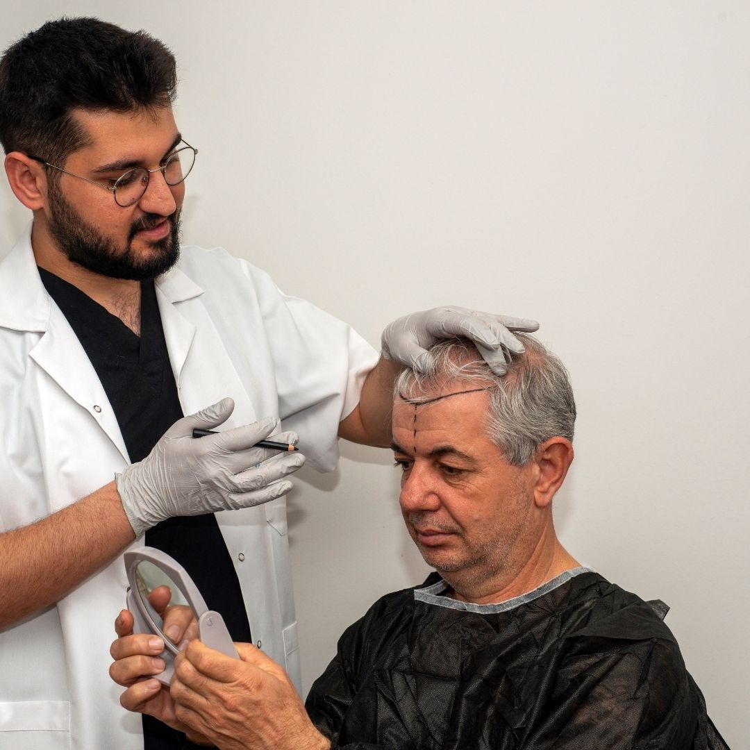 Types of Hair Transplant Procedures Available in Turkey