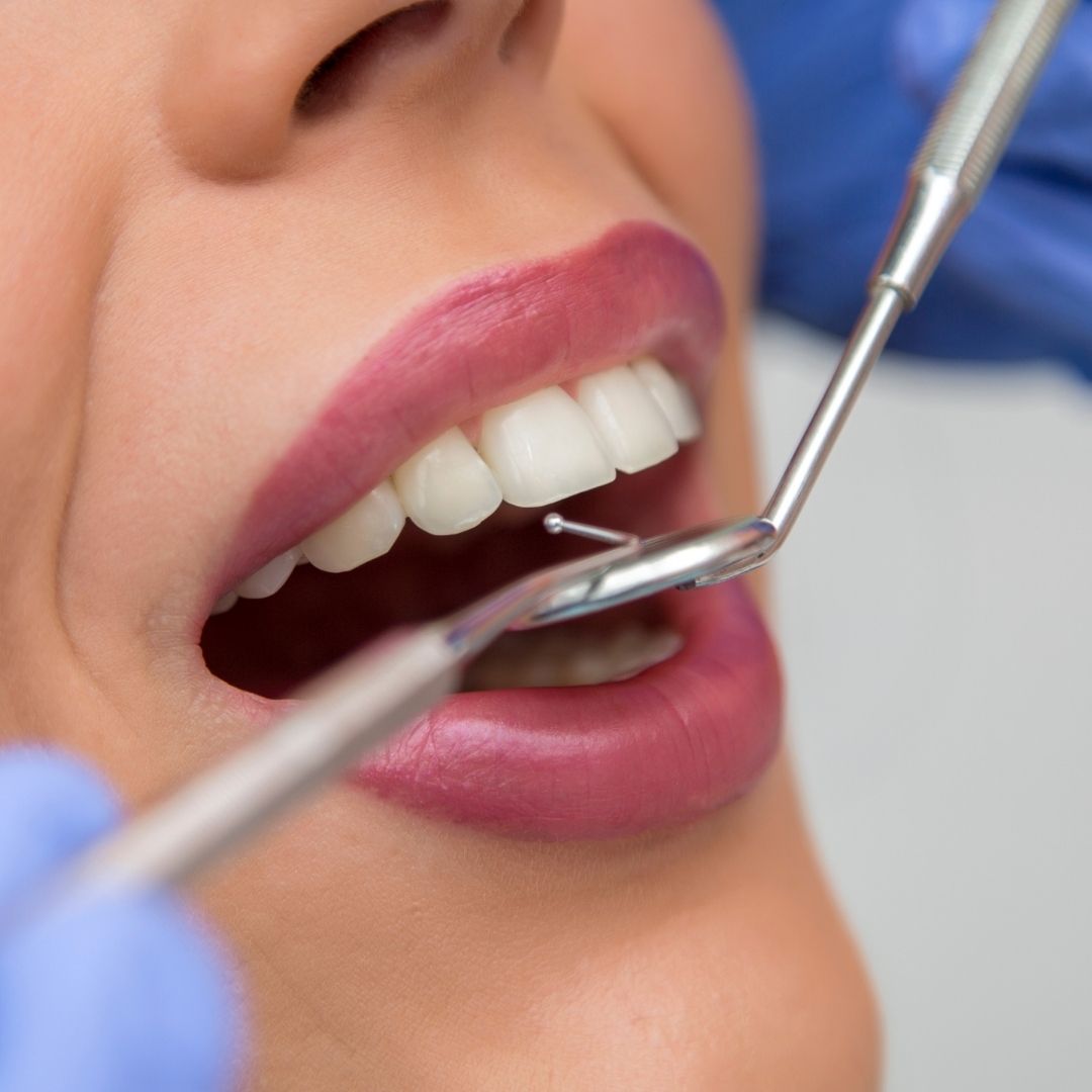 The Benefits of Receiving Dental Care in Turkey