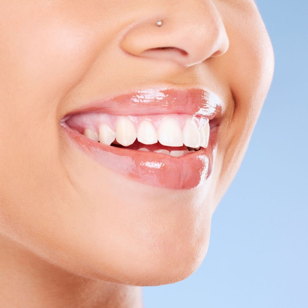 The Range of Cosmetic Dentistry Procedures Available in Turkey
