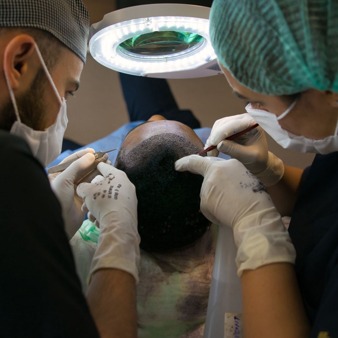 Alternative Hair Restoration Options for Those Unsuitable for DHI Pro Hair Transplant in Turkey