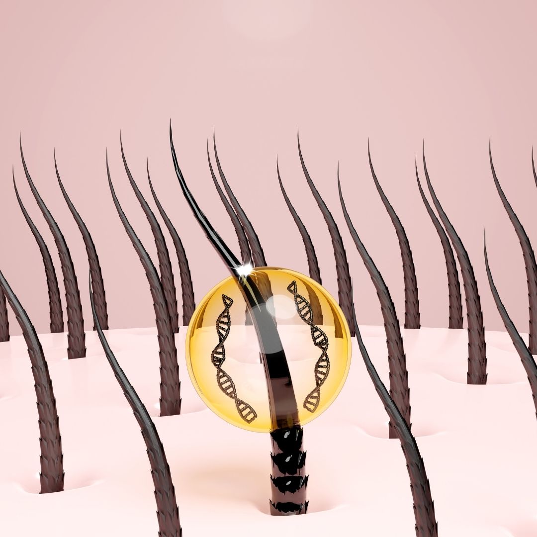 ترکی میں ایف یو ای ہیئر ٹرانسپلانٹ کے سرجن