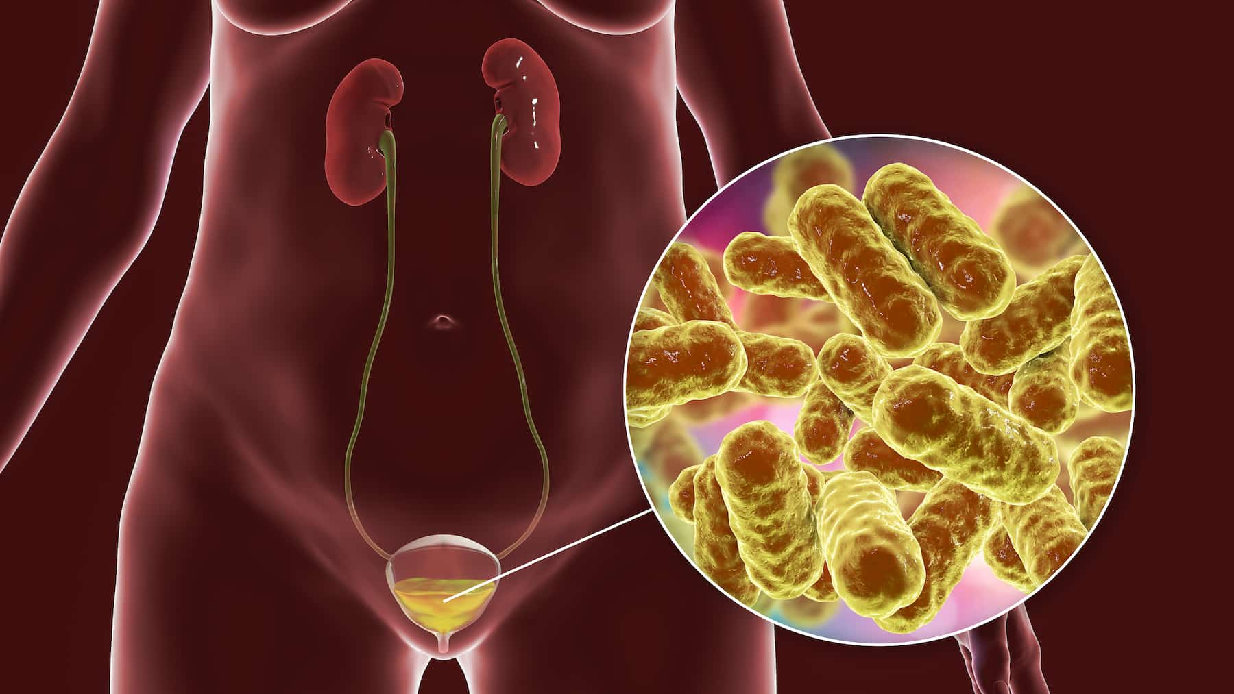 Cystoscopy turkey