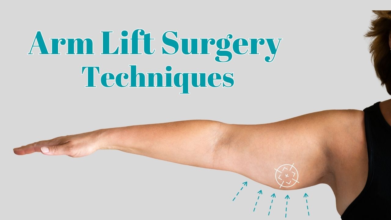 Arm lift surgery techniques