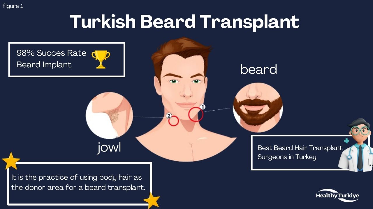 Turkish beard