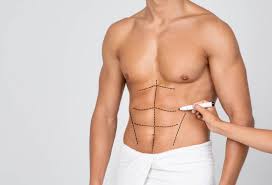 Cost of Abdominal Etching in Turkey