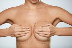 Breast Lift Surgeons in Turkey