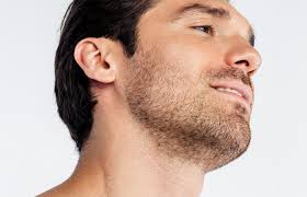 Beard Transplant Results in Turkey