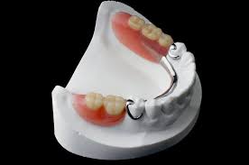 Dentures Results in Turkey
