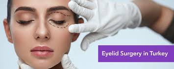 Cost of Eyelid Surgery in Turkey