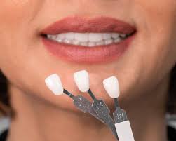 Aftercare for Porcelain Veneers in Turkey