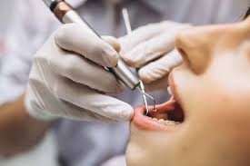 Aftercare for Root Canal Treatment in Turkey