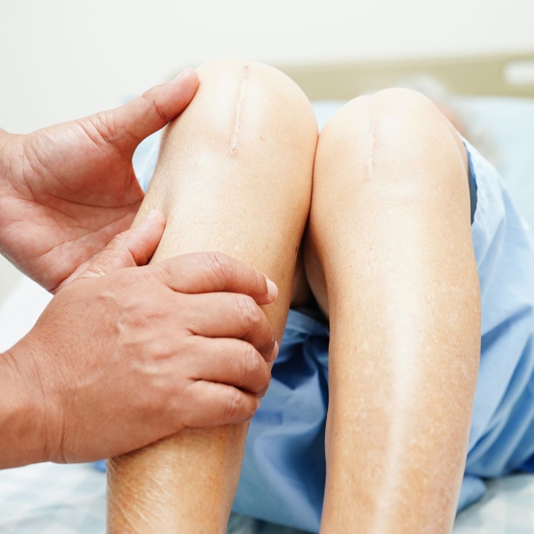 Knee Replacement Surgery Surgeons in Turkey