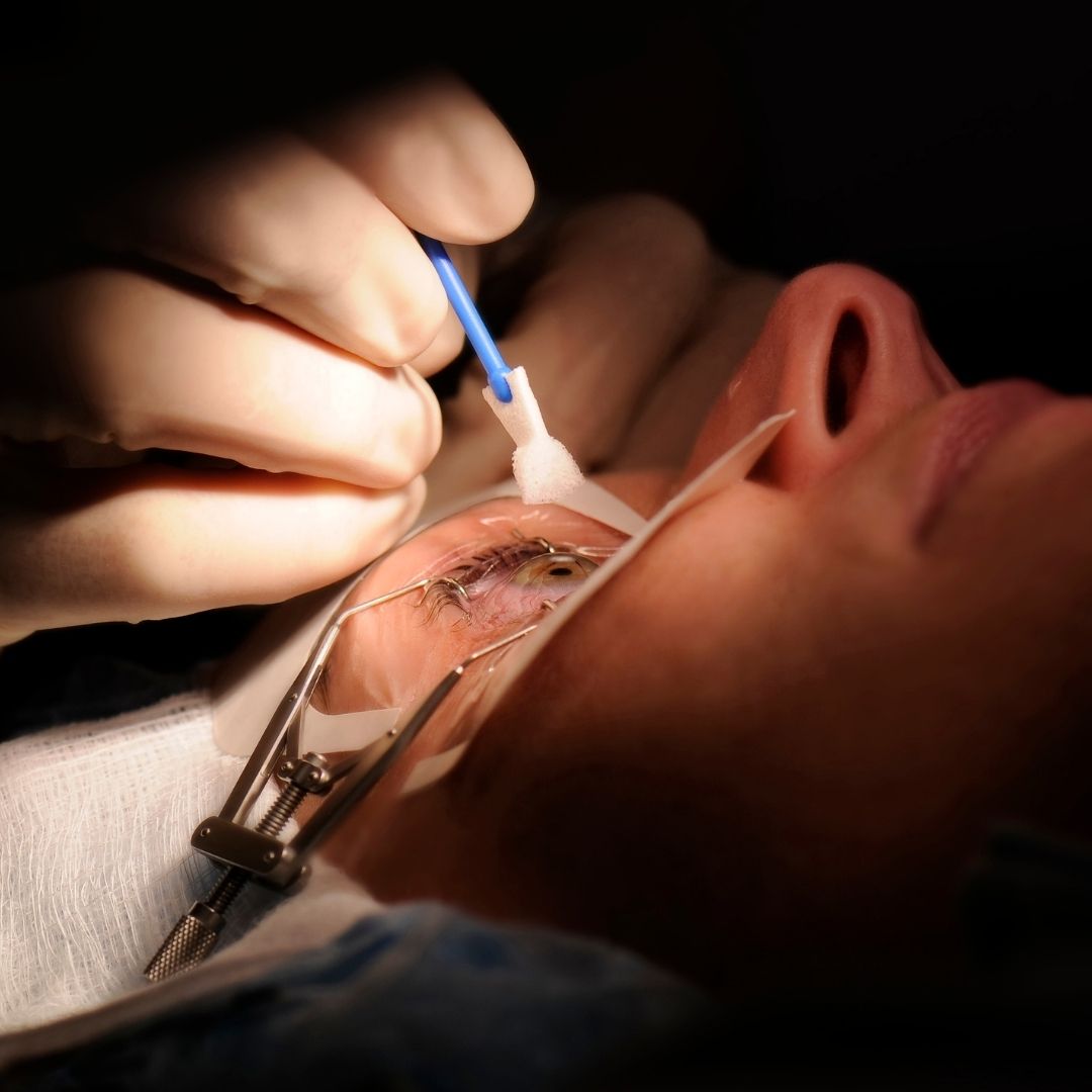 Lasik Eye Surgery Surgeons in Turkey