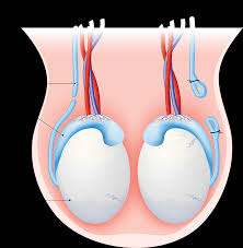 vasectomy results in turkey