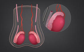 Aftercare for Vasectomy in Turkey