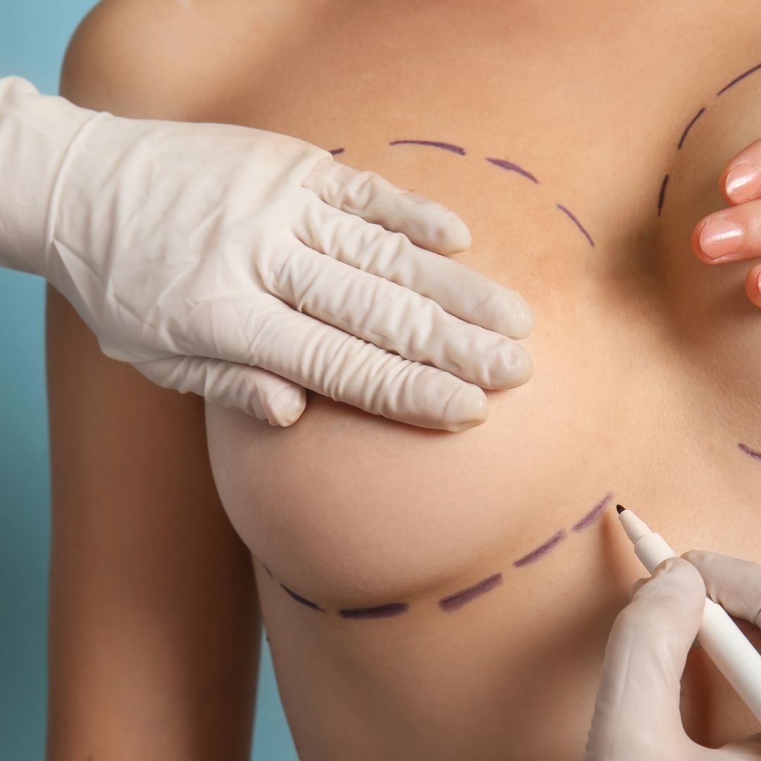 Cost of Breast Augmentation in Turkey