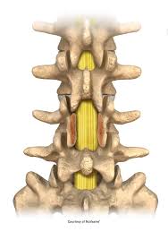 laminectomy surgery results in turkey