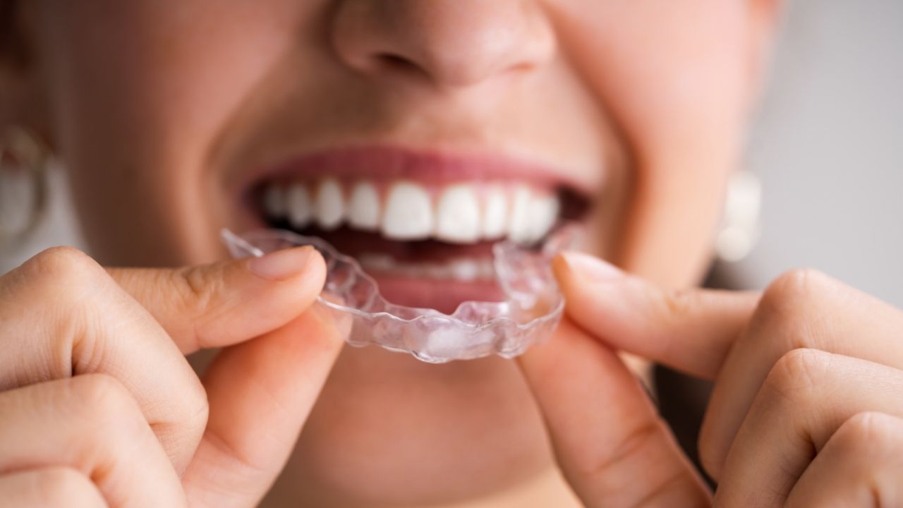 Invisalign in turkey