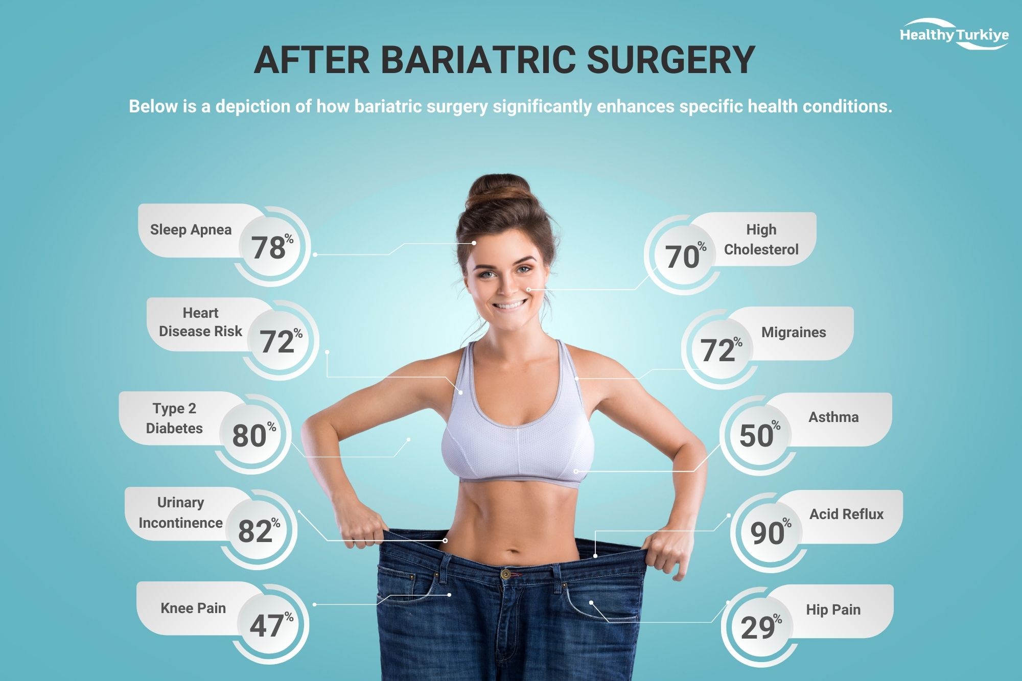 Bariatric turkey surgery