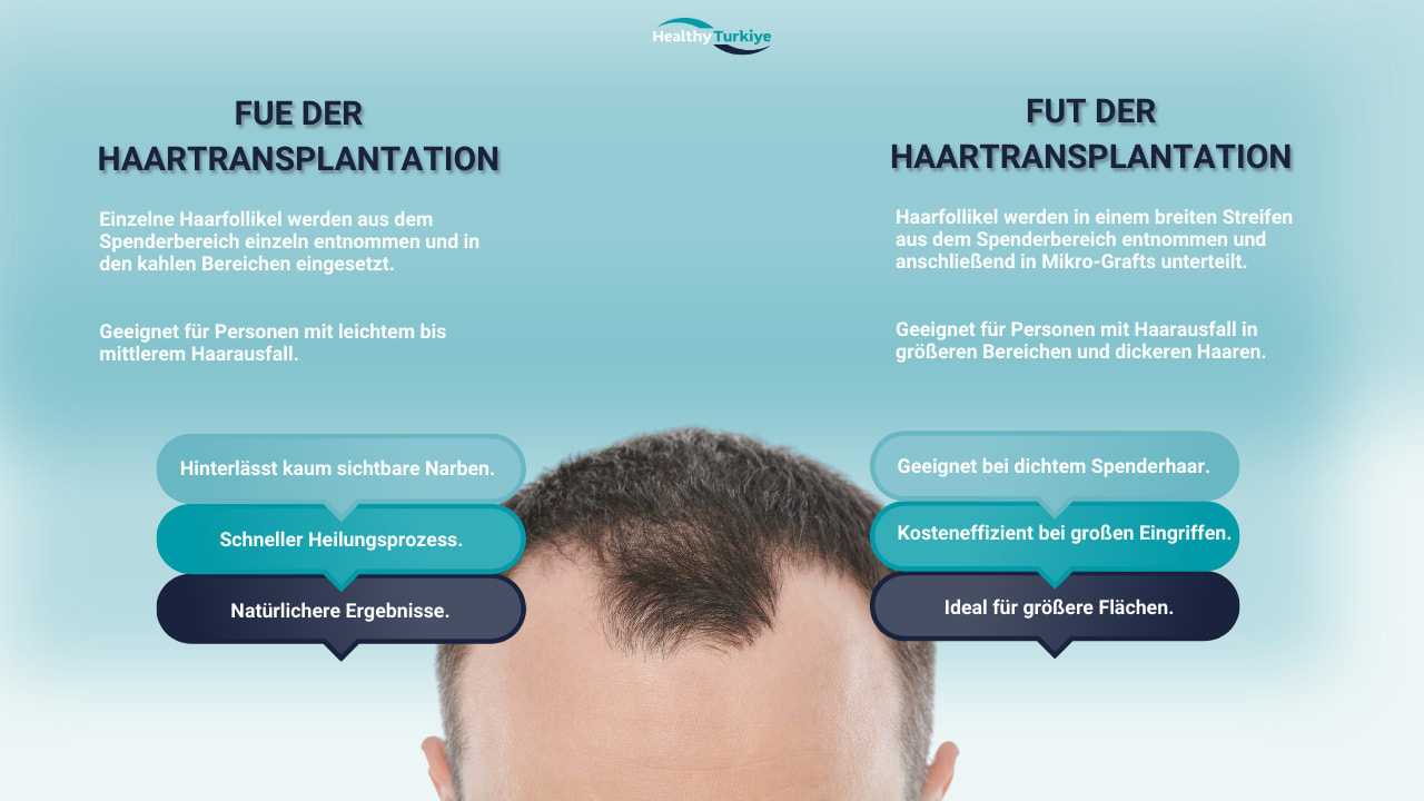 Haartransplantation in turkei