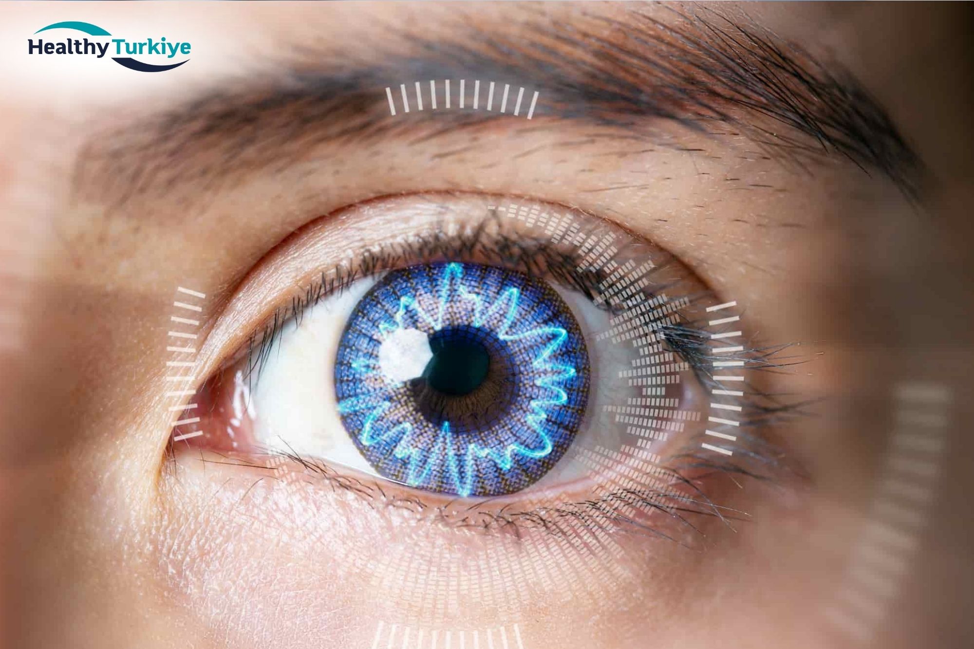 Turkiye lasik eye surgery