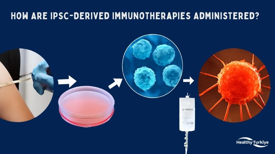 Ipsc derived immunotherapies turkey