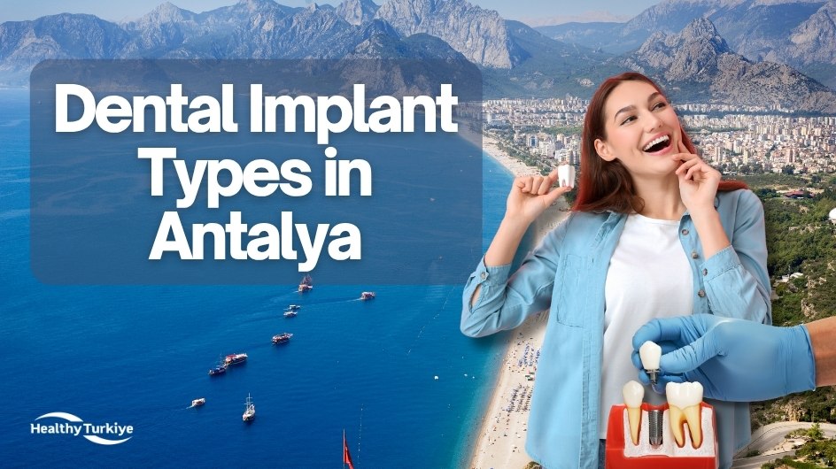 Types of Dental Implants in Antalya: A Guide for International Patients