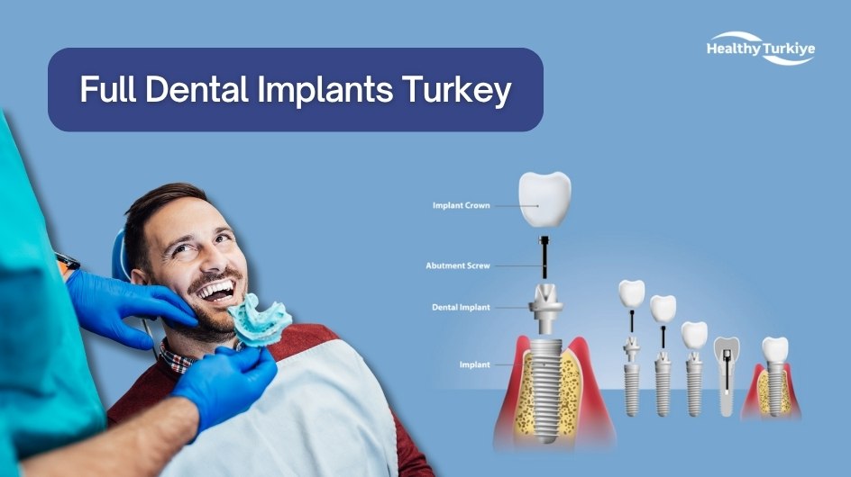 Full mouth dental implant turkiye Full mouth dental implant turkiye