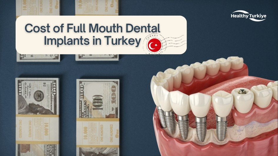 Full mouth dental implant in turkiye Full mouth dental implant in turkiye