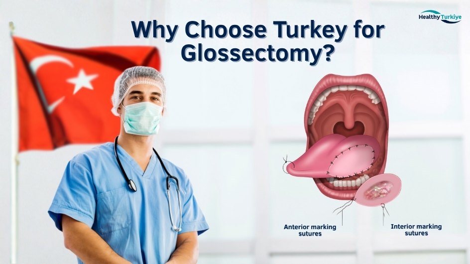 Turkiye glossectomy Turkiye glossectomy