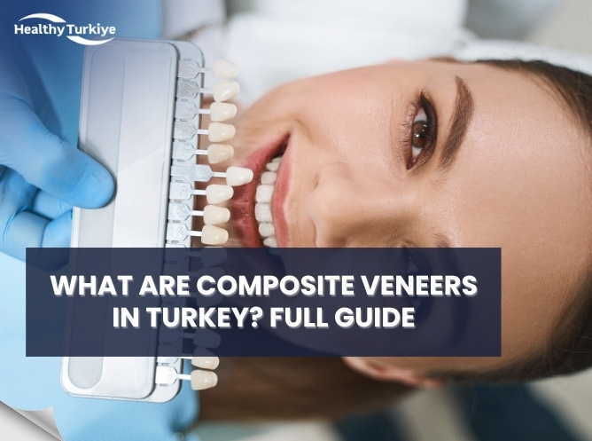 What Are Composite Veneers in Turkey? Full 2026 Guide