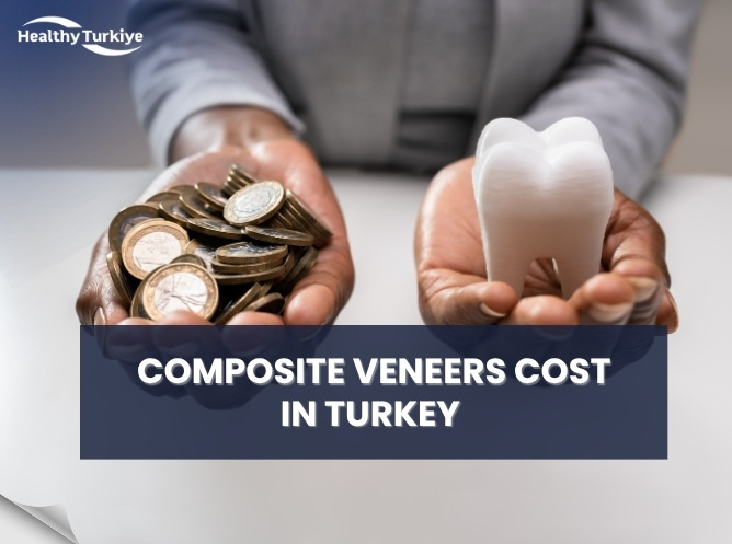 Composite Veneers Cost in Turkey 2026: Full Price Breakdown