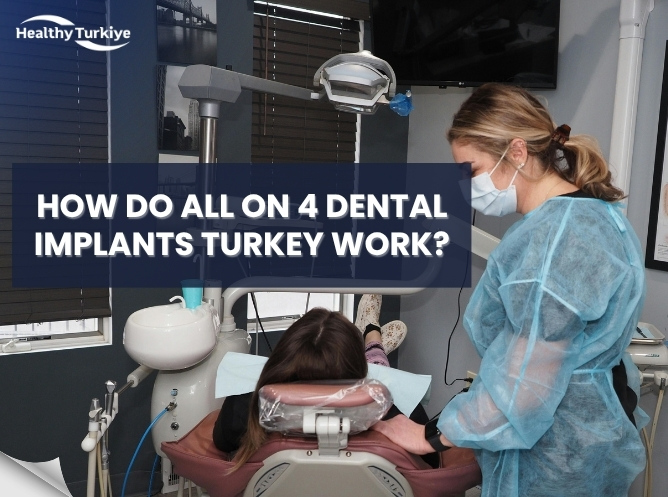 How Do All on 4 Dental Implants Turkey Work? Step-by-Step