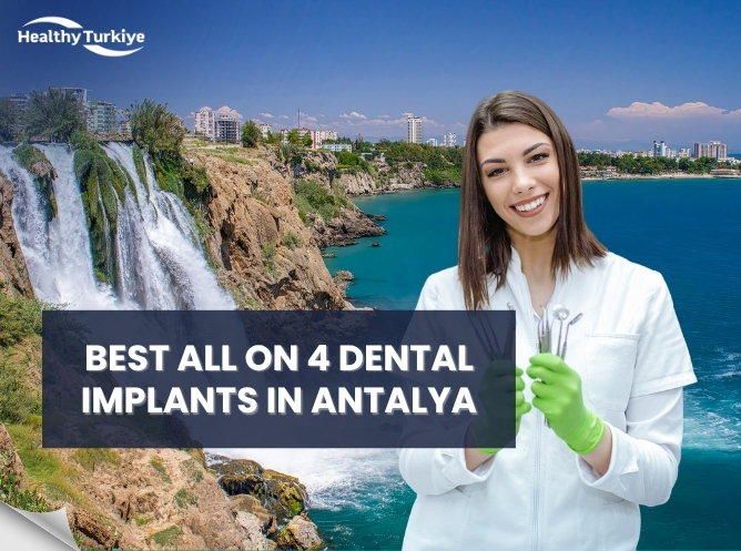 Best All on 4 Dental Implants in Antalya
