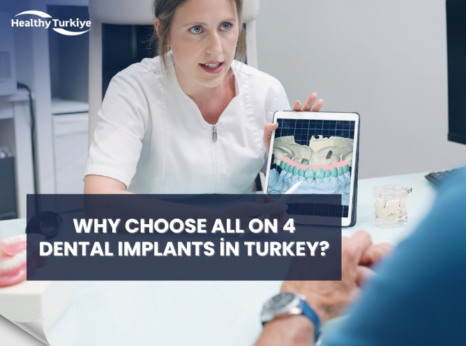 Why Choose All on 4 Dental Implants in Turkey?
