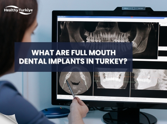 what are full mouth dental implants turkey