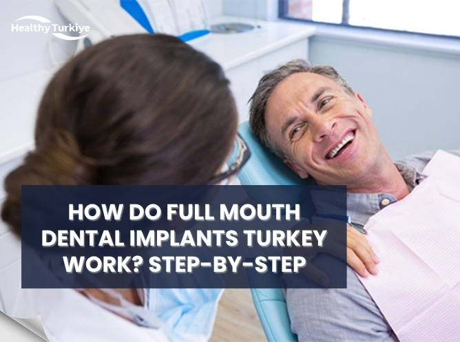 how full mouth dental implants turkey work step by step