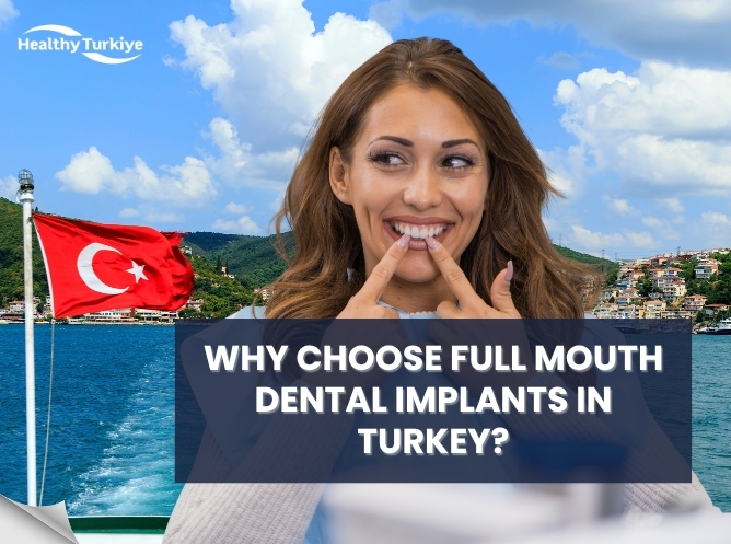 Why Choose Full Mouth Dental Implants in Turkey?
