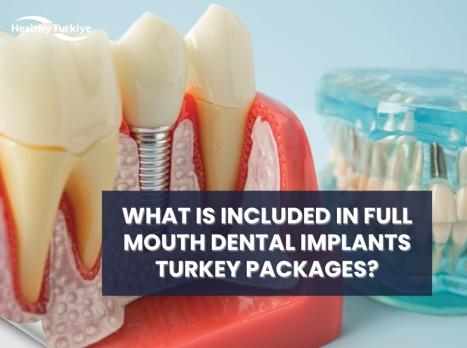 What Is Included in Full Mouth Dental Implants Turkey Packages?