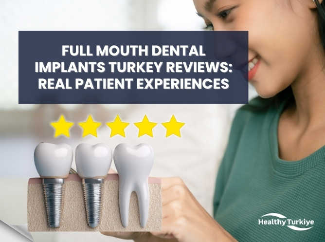Full Mouth Dental Implants Turkey Reviews: Real Patient Experiences