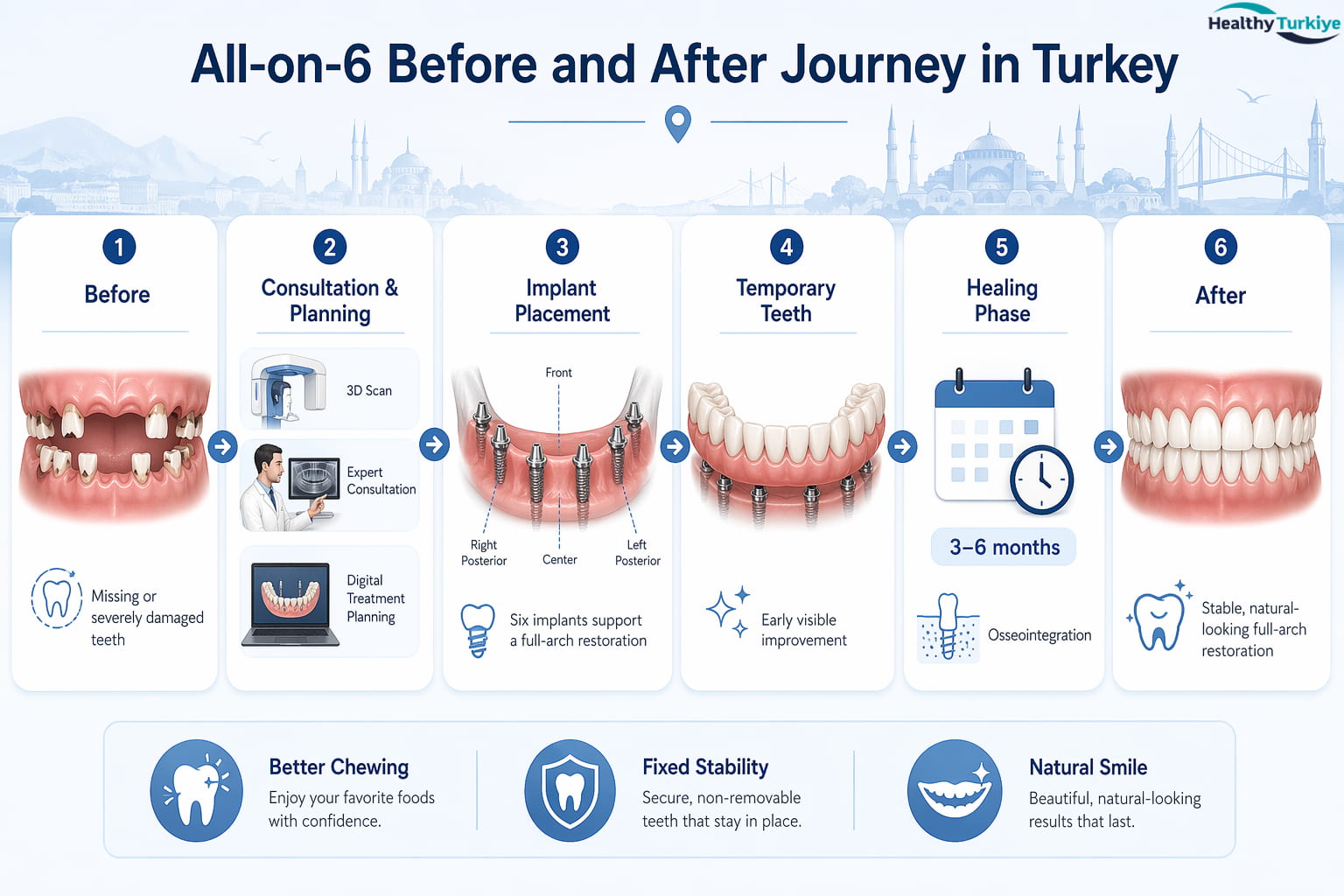 All-on-6 in Turkey Before and After: What Results Can You Expect?