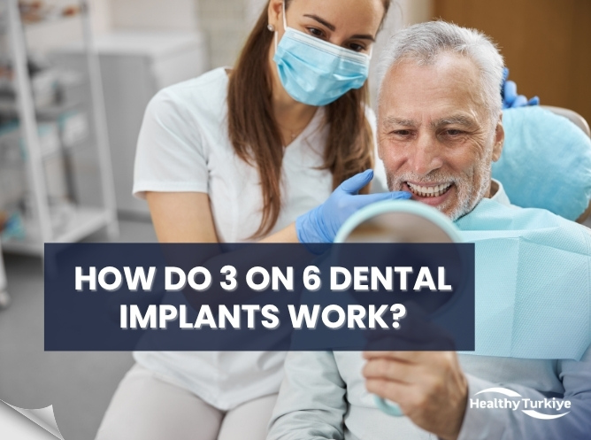 how do 3 on 6 dental implants work step by step