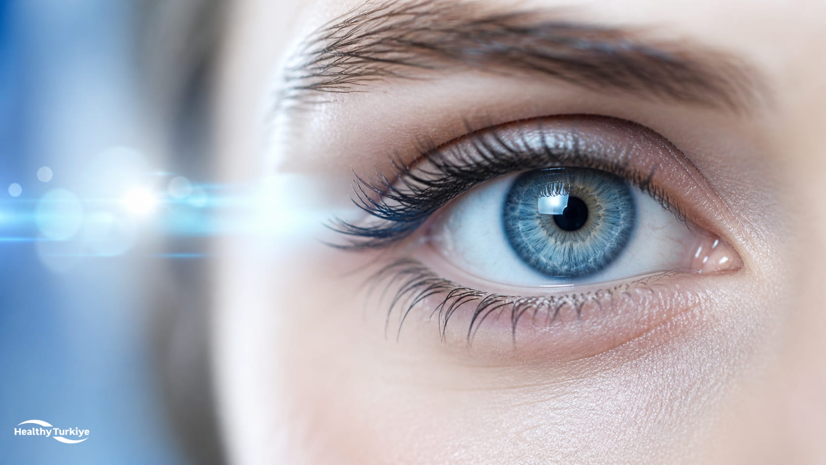 Stroma laser procedure in turkey
