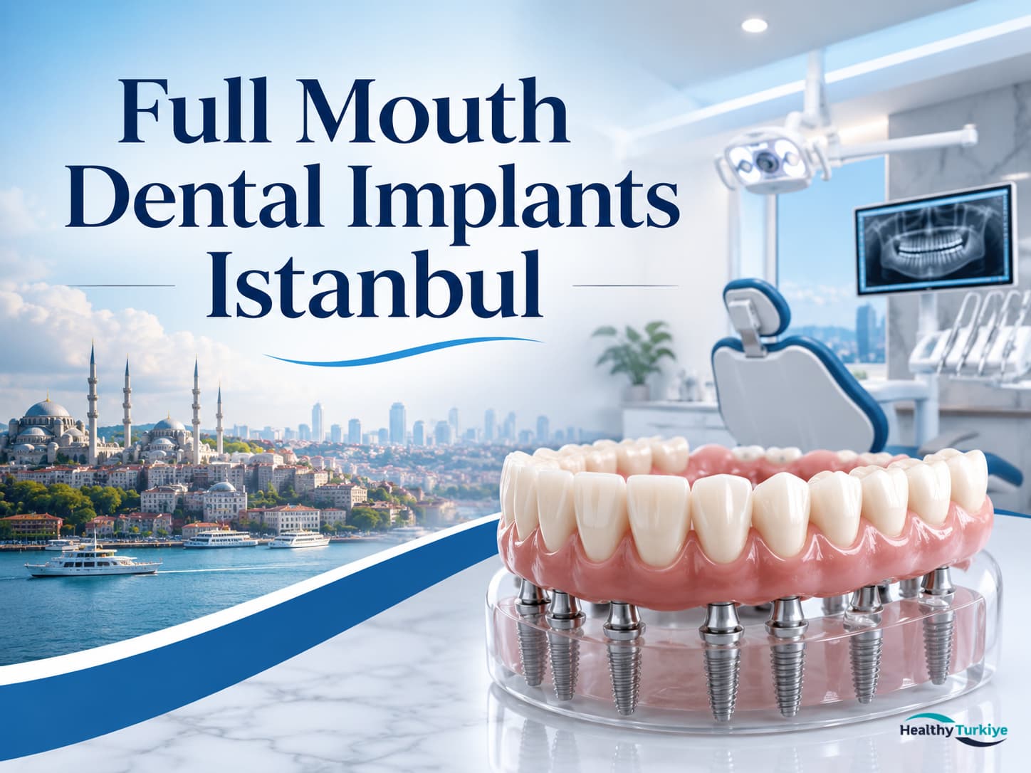 Full Mouth Dental Implants Istanbul: Cost, Procedure, Packages and Full Guide 2026